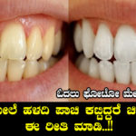 remedies-for-yellow-teeth-in-kannada
