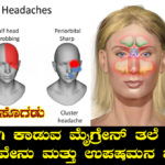 causes-of-migraine-headache