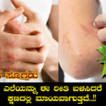 home-remedies-for-itching-in-kannada