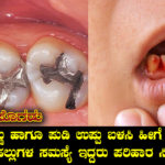 solution-for-dental-problems-in-kannada