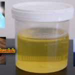 your-urine-color-your-health-full-detail-learn