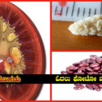 how-to-remove-kidney-stones-without-operation