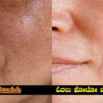 face-skin-small-pores-with-black-removal-easy-method